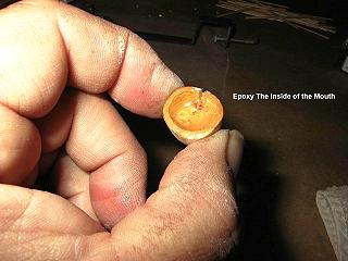 Epoxy Applied to Mouth