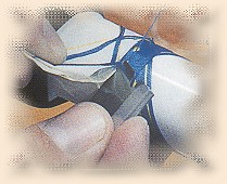 Procedures fully illustrated